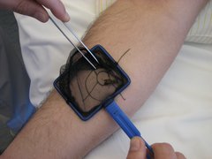 Allergiezentrum Heilbronn-Franken: Insektenstich